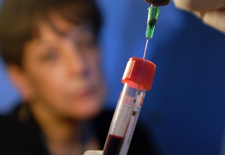 Examen de SIDA (32).JPG