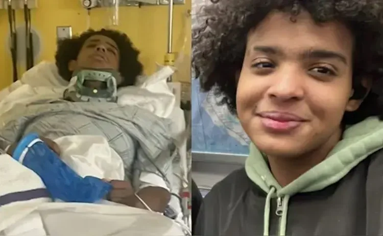 adolescente sobrevive tras ser alcanzado por un rayo bajo un árbol rppusa