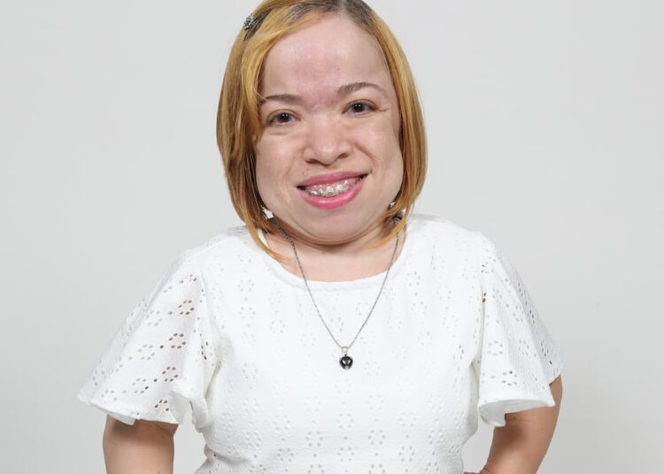 Pediatras, atentos: señales que permiten detectar a tiempo la Mucopolisacaridosis IV A