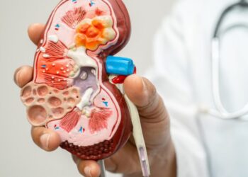 Por qué está aumentando el número de pacientes con enfermedad renal, según un estudio